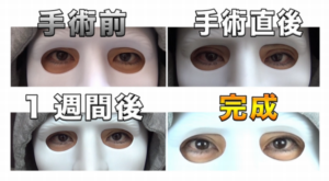 顔 ラファエル